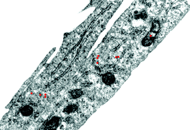 Graphical abstract: Possible exploitation of magnetic nanoparticle–cell interaction for biomedical applications