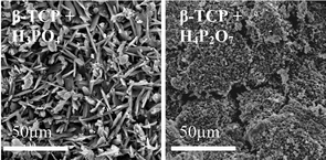 Graphical abstract: Temperature dependent setting kinetics and mechanical properties of β-TCP–pyrophosphoric acid bone cement