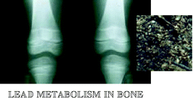 Graphical abstract: The study of age influence on human bone lead metabolism by using a simplified model and X-ray fluorescence data