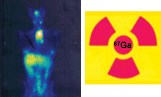 Graphical abstract: Towards molecular imaging and treatment of disease with radionuclides: the role of inorganic chemistry