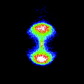 Graphical abstract: Time-resolved photoion and photoelectron imaging of NO2