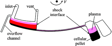Graphical abstract: Centrifugal extraction of plasma from whole blood on a rotating disk