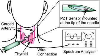 Graphical abstract: Micromachined bulk PZT tissue contrast sensor for fine needle aspiration biopsy