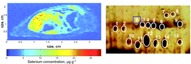 Graphical abstract: Laser ablation inductively coupled plasma mass spectrometry (LA-ICP-MS) in elemental imaging of biological tissues and in proteomics