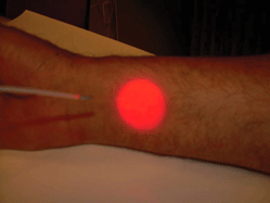 Graphical abstract: Milestones in the development of photodynamic therapy and fluorescence diagnosis