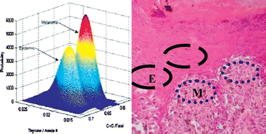 Graphical abstract: Distinction of malignant melanoma and epidermis using IR micro-spectroscopy and statistical methods