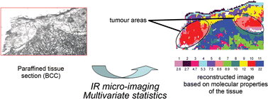 Graphical abstract: Combination of FTIR spectral imaging and chemometrics for tumour detection from paraffin-embedded biopsies