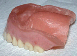 Graphical abstract: The influence of denture cleansers on the release of organic compounds from soft lining materials