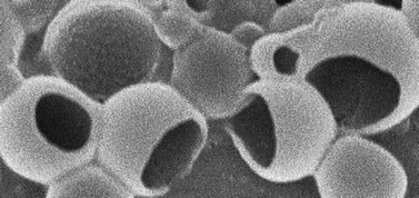 Graphical abstract: Colloidal buckets formed via internal phase separation