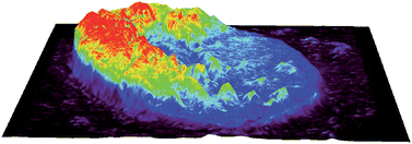 Graphical abstract: Elemental bio-imaging of melanoma in lymph node biopsies