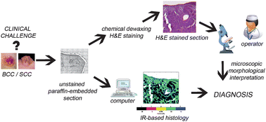 Graphical abstract: Differential diagnosis of cutaneous carcinomas by infrared spectral micro-imaging combined with pattern recognition