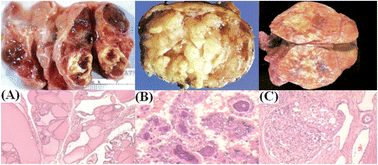 Graphical abstract: Thyroid tissue analysis through Raman spectroscopy