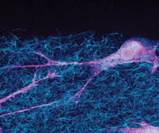 Graphical abstract: The compaction of gels by cells: a case of collective mechanical activity