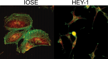 Graphical abstract: Adhesion and migration of ovarian cancer cells on crosslinked laminin fibers nanofabricated by multiphoton excited photochemistry