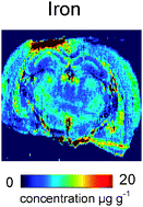 Graphical abstract: Bioimaging of metals in brain tissue by laser ablation inductively coupled plasma mass spectrometry (LA-ICP-MS) and metallomics