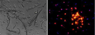 Graphical abstract: Hydrogel/electrospun fiber composites influence neural stem/progenitor cell fate