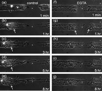 Graphical abstract: Examination of axonal injury and regeneration in micropatterned neuronal culture using pulsed laser microbeam dissection