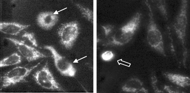 Graphical abstract: The photosensitizing activity of lumazine using 2′-deoxyguanosine 5′-monophosphate and HeLa cells as targets