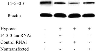 Graphical abstract: Differential protein expression level identification by knockout of 14-3-3τ with siRNA technique and 2DE followed MALDI-TOF-TOF-MS