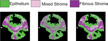 Graphical abstract: Accurate histopathology from low signal-to-noise ratio spectroscopic imaging data