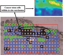 Graphical abstract: Evidence for a stem-cell lineage in corneal squamous cell carcinoma using synchrotron-based Fourier-transform infrared microspectroscopy and multivariate analysis