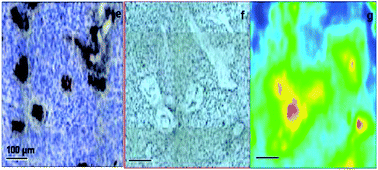 Graphical abstract: Differentiation between normal and tumor vasculature of animal and human glioma by FTIR imaging