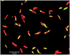 Graphical abstract: Observation of content and heterogeneity of poly-β-hydroxybutyric acid (PHB) in Legionella bozemanii by vibrational spectroscopy