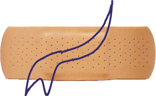 Graphical abstract: Plaster-trodes for electro-analytical sensing viaelectrodeposition with electro-catalytic metals