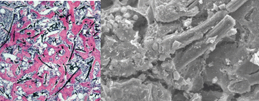 Graphical abstract: Application of carbon fibers to biomaterials: A new era of nano-level control of carbon fibers after 30-years of development