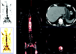 Graphical abstract: Generator-based PET radiopharmaceuticals for molecular imaging of tumours: on the way to THERANOSTICS