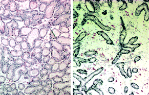 Graphical abstract: Application of a battery of biomarkers in mussel digestive gland to assess long-term effects of the Prestige oil spill in Galicia and Bay of Biscay: Tissue-level biomarkers and histopathology