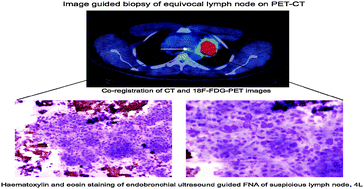 Graphical abstract: The challenges of integrating molecular imaging into the optimization of cancer therapy