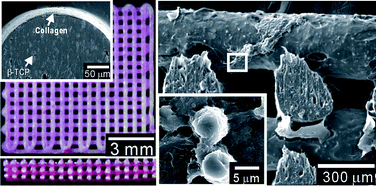 Graphical abstract: Three-dimensional plotted PCL/β-TCP scaffolds coated with a collagen layer: preparation, physical properties and in vitro evaluation for bone tissue regeneration