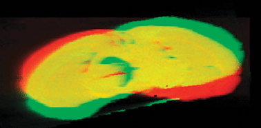 Graphical abstract: Three-dimensional elemental bio-imaging of Fe, Zn, Cu, Mn and P in a 6-hydroxydopamine lesioned mouse brain