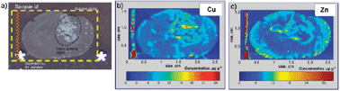 Graphical abstract: Trace metal imaging with high spatial resolution: Applications in biomedicine