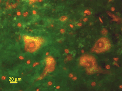 Graphical abstract: Functionalized gold nanoparticles: a detailed in vivo multimodal microscopic brain distribution study