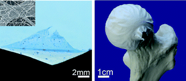 Graphical abstract: Two-layer membranes of calcium phosphate/collagen/PLGA nanofibres: in vitro biomineralisation and osteogenic differentiation of human mesenchymal stem cells