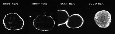 Graphical abstract: Human serum albumin as key mediator of the differential accumulation of hypericin in normal urothelial cell spheroids versusurothelial cell carcinoma spheroids