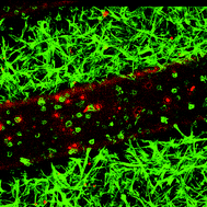 Graphical abstract: Patterning hydrogels in three dimensions towards controlling cellular interactions