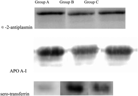 Graphical abstract: Quantitative proteomic analysis of serum proteins in patients with Parkinson’s disease using an isobaric tag for relative and absolute quantification labeling, two-dimensional liquid chromatography, and tandem mass spectrometry