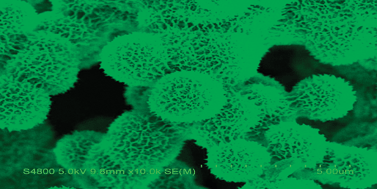 Graphical abstract: Urchin-like Ni–P microstructures: facile synthesis, properties and application in the fast removal of heavy-metal ions