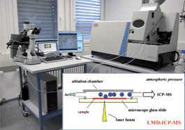 Graphical abstract: Mass spectrometric imaging of elements in biological tissues by new BrainMet technique—laser microdissection inductively coupled plasma mass spectrometry (LMD-ICP-MS)