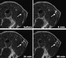 Graphical abstract: Preparation and characterization of MRI-active gadolinium nanocomposite particles for neutron capture therapy