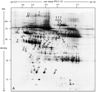 Graphical abstract: A proteomic approach to identify plasma proteins in patients with abdominal aortic aneurysm