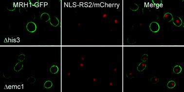 Graphical abstract: Secretory pathway genes assessed by high-throughput microscopy and synthetic genetic array analysis