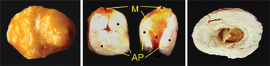 Graphical abstract: Analytical investigation of salivary calculi, by mid-infrared spectroscopy