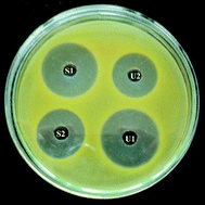 Graphical abstract: Development and validation of microbial bioassay for the quantification of potency of the antibiotic cefuroxime axetil