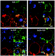 Graphical abstract: Effects of zinc and strontium substitution in tricalcium phosphate on osteoclast differentiation and resorption