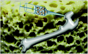 Graphical abstract: Citrate-based biodegradable injectable hydrogel composites for orthopedic applications