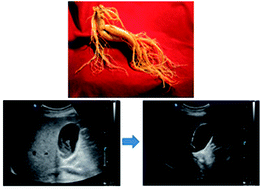 Graphical abstract: Effects of Korean red ginseng as an adjuvant to bile acids in medical dissolution therapy for gallstones: a prospective, randomized, controlled, double-blind pilot trial